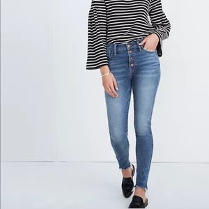 Madewell button up skinny jeans